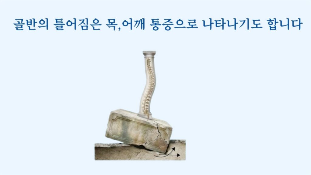 물리치료 받아도 통증 그대로라면