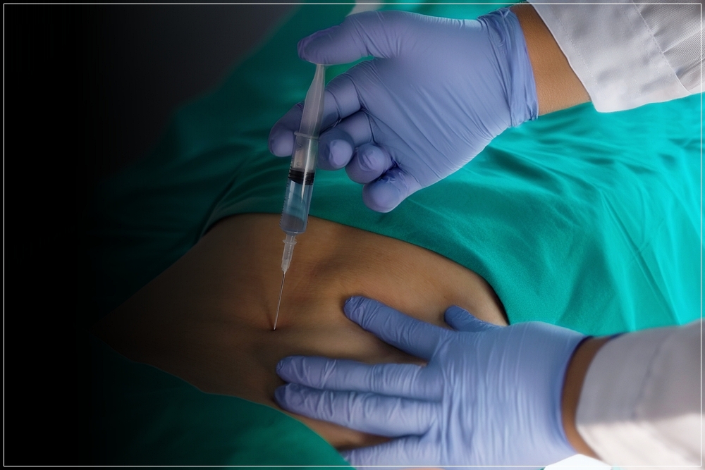 허리디스크 신경차단술주사