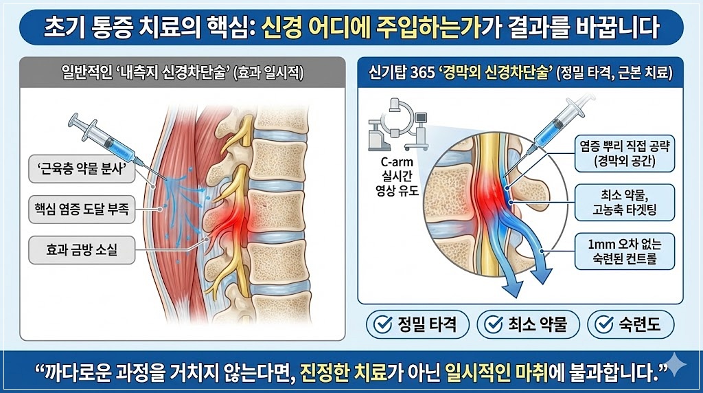 초기 통증 치료의 핵심
