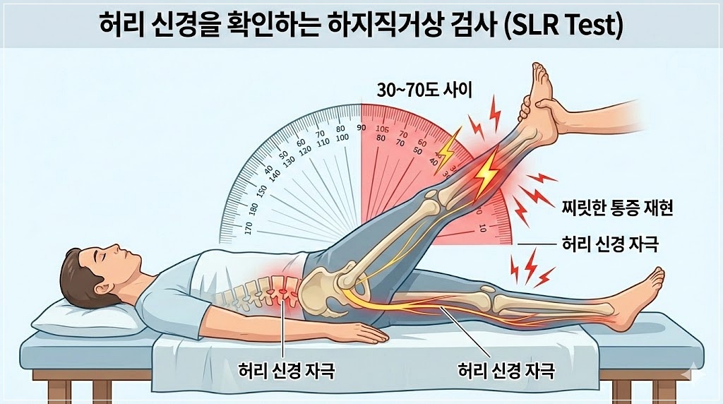 인천 하지방사통 발바닥 저림 하지직거상검사방법
