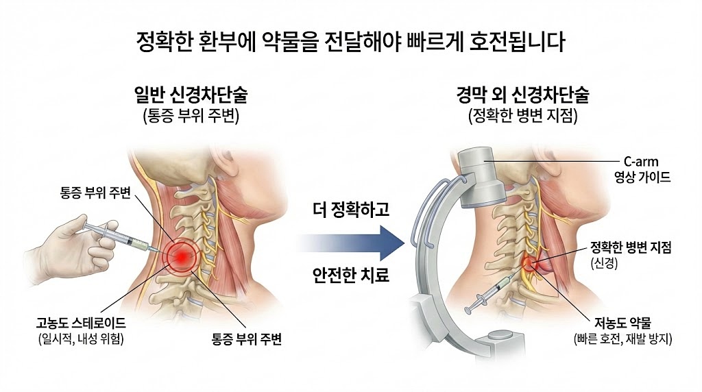 주안동 목디스크 비수술 경막 외 신경차단술